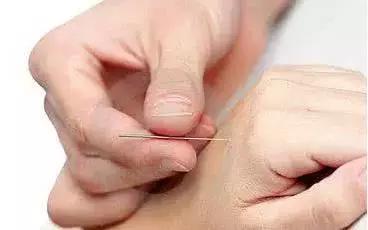 针灸治痛的三则与十法