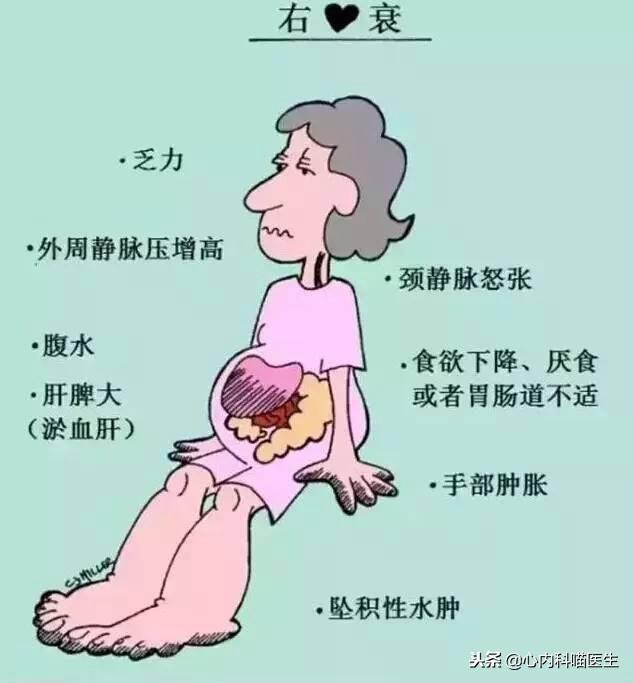 芪苈强心胶囊治疗心衰的好中药心内科医生眼中的中药