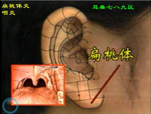    耳背穴位