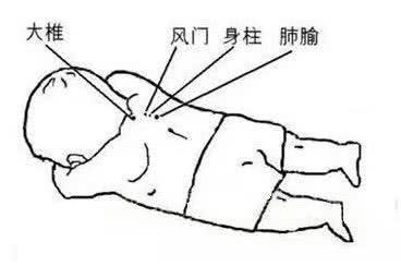 *咳嗽,哮喘更快的处理方法——吮痧 - 好网角收藏夹