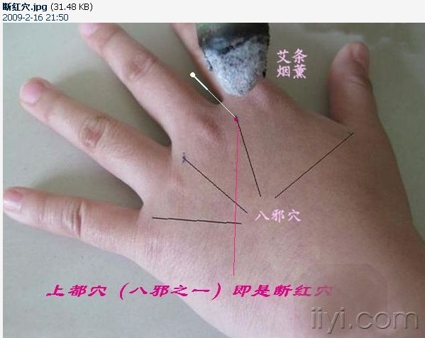 女福穴和断红穴