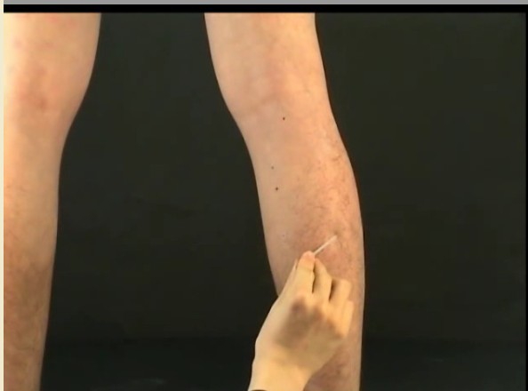 取穴:在小腿后侧,金生穴直上一寸处.