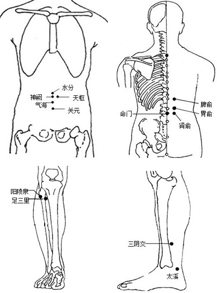 针灸拔罐减肥的具体方法
