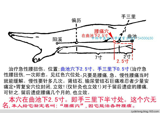 一针一穴治腰痛