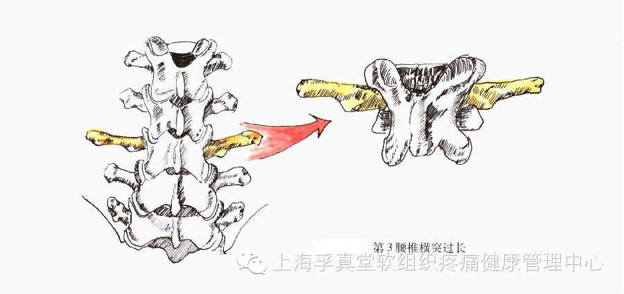 橫突長,附著在橫突上的有腰脊筋膜之深層及腰方肌,橫突的背側有骶棘肌