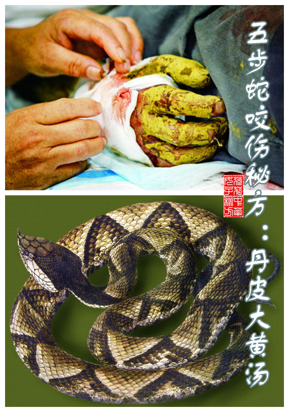 五步蛇咬伤秘方丹皮大黄汤