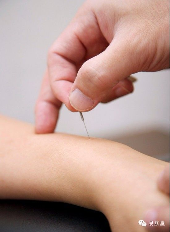 让你扬名立万的特效穴特效针灸班上课精华内容