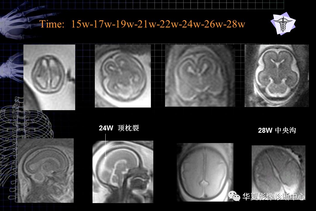 確定孕檢查哪些項目_喉癌做什么檢查能確定_影像學檢查可以確定