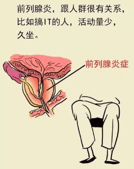 男科聖手徐福松老師治療慢性前列腺炎經驗方萆菟湯