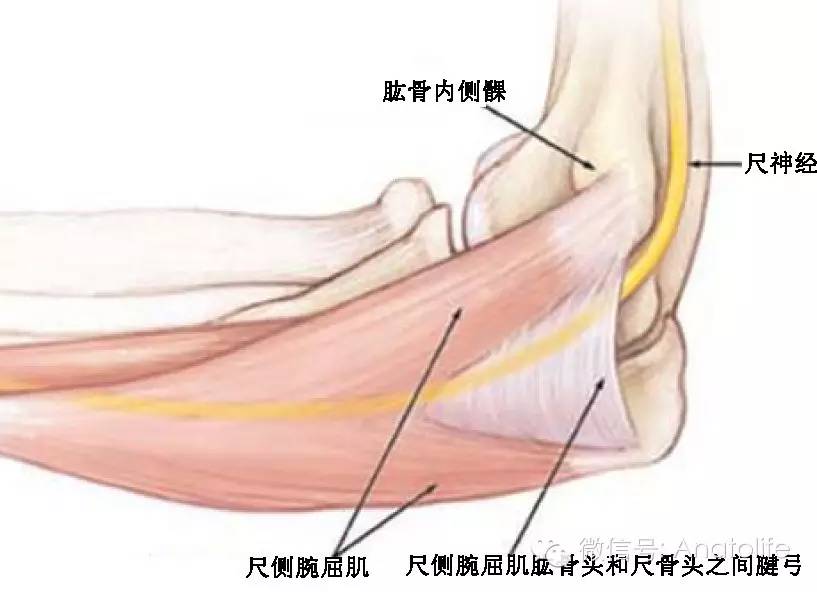 頂為連結肱骨內上髁和鷹嘴內側面的三角形的弓形韌帶