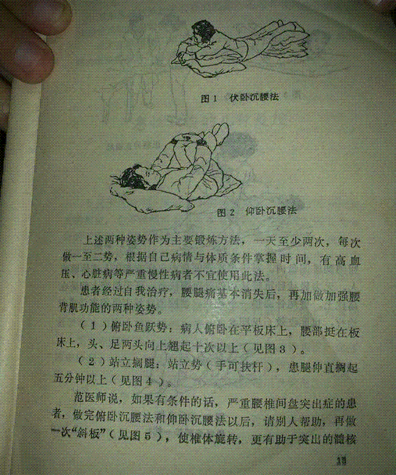 快速治愈腰椎间盘突出法