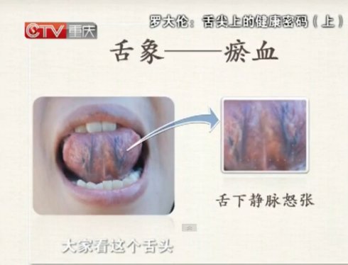 罗大伦罗大中讲中医舌诊舌头与脏腑的关系