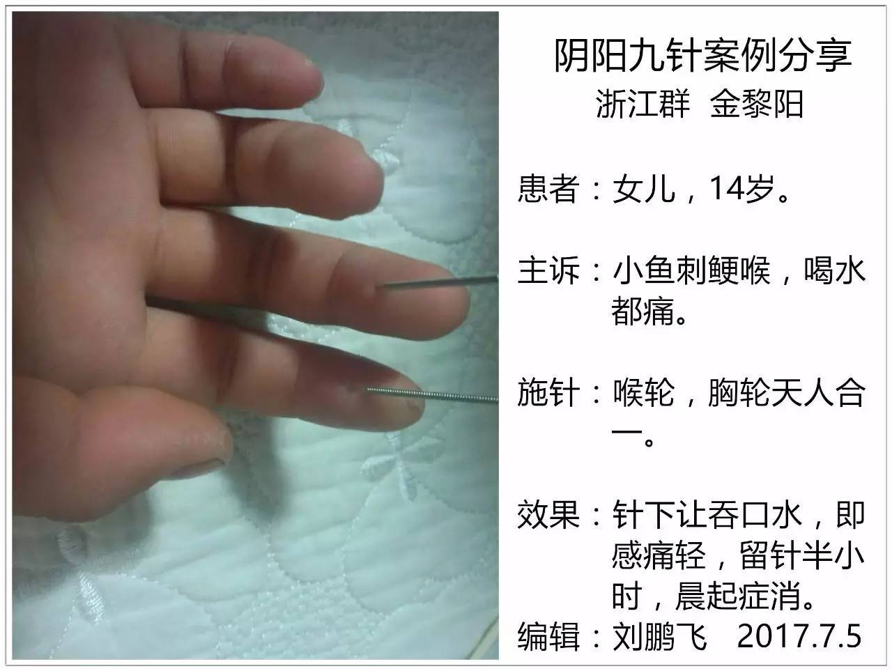 阴阳九针日报(2017.7.8)