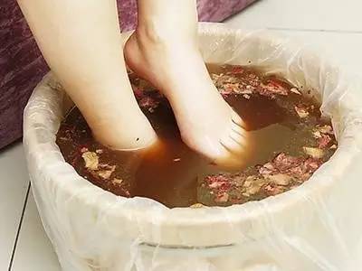 9,皲裂:泡脚 橘子皮很多南方人,习惯了南方的湿润,到了北方,干燥的