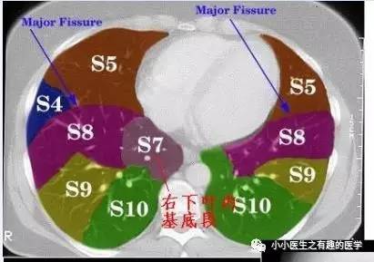 胸部ct解剖入门技巧轻松掌握肺段分布及重要血管