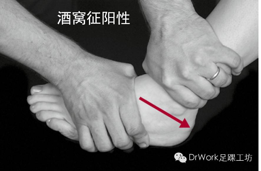 lee教授经验小结1,"略带旋转的抽屉试验"2,"双手十指全用上用拇指去