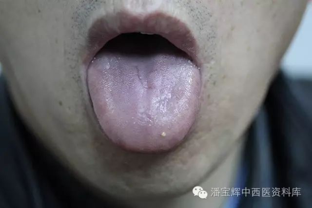 李玉宾用药组织图图片