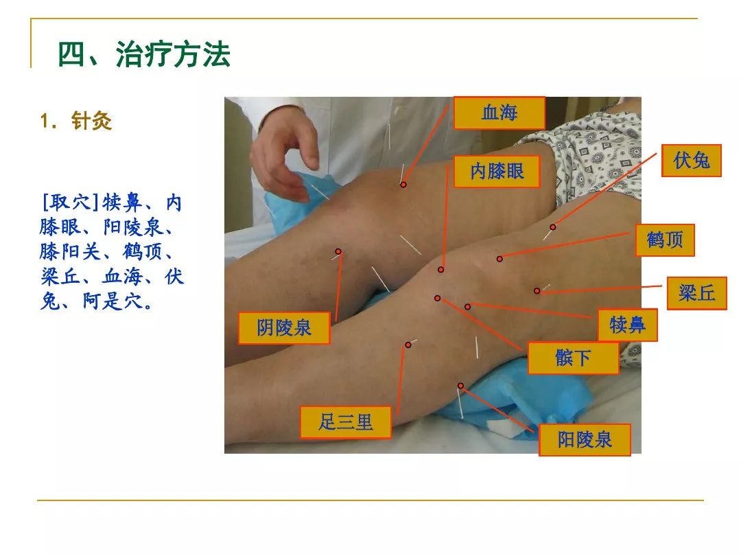 膝关节周围疼痛的针刺和针刀治疗