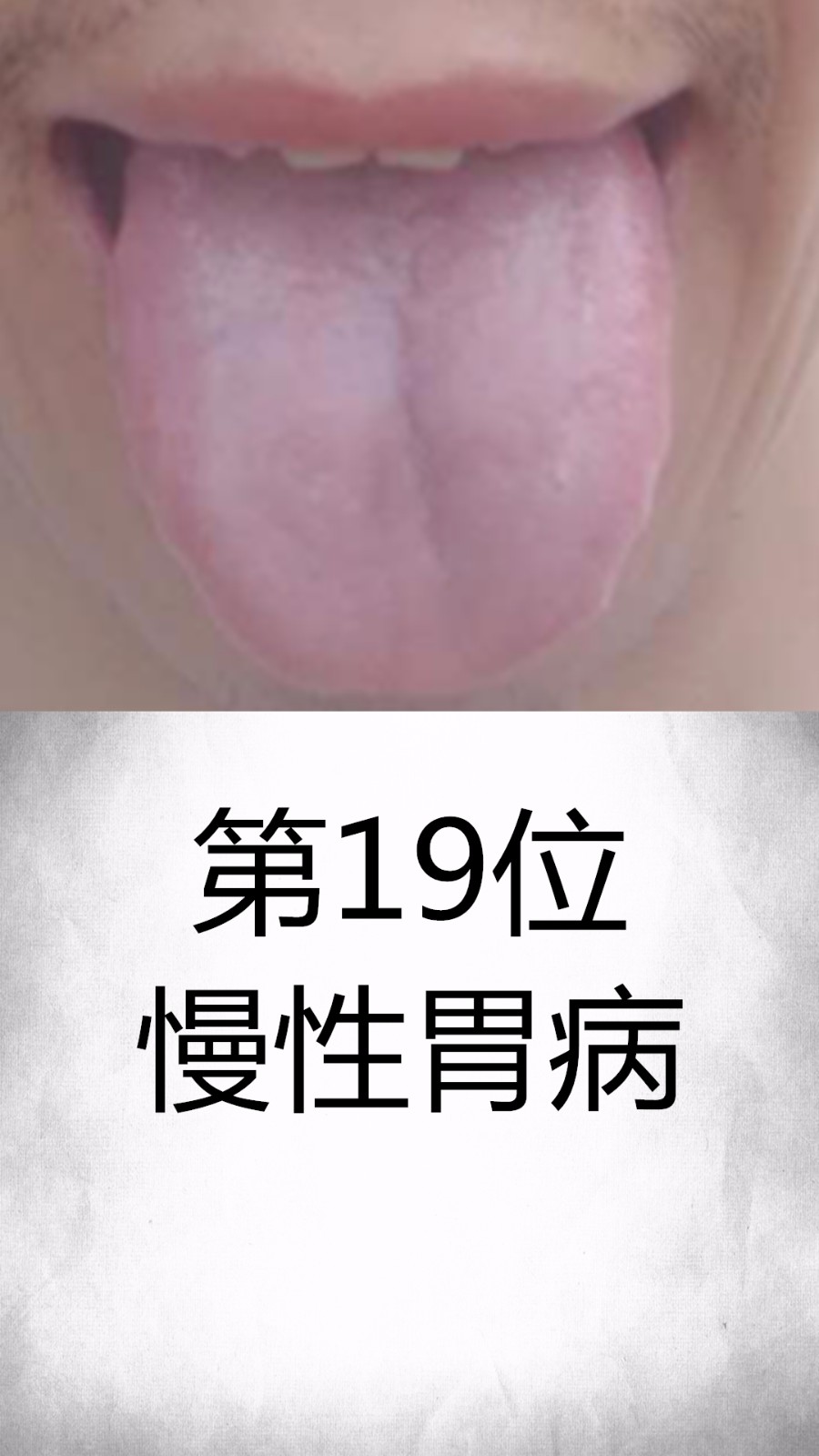 原舌诊哥帮助大家学习舌诊合集三