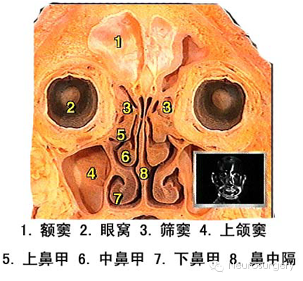 颅后面观: 乳突,枕外隆突,上项线, 颅底内面观:⑴ 颅前窝,鸡冠,筛孔