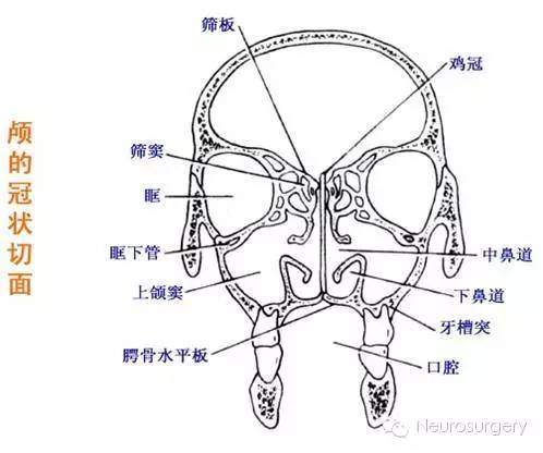 颅骨冠状面解剖图图片