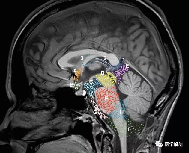 經典收藏頭顱mr矢狀位中線結構解剖