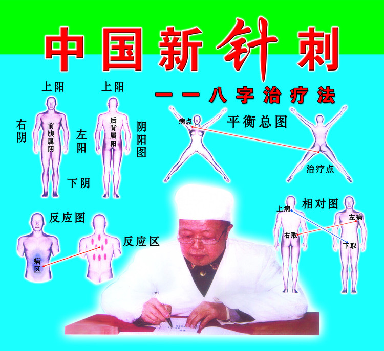 八字针灸治疗法