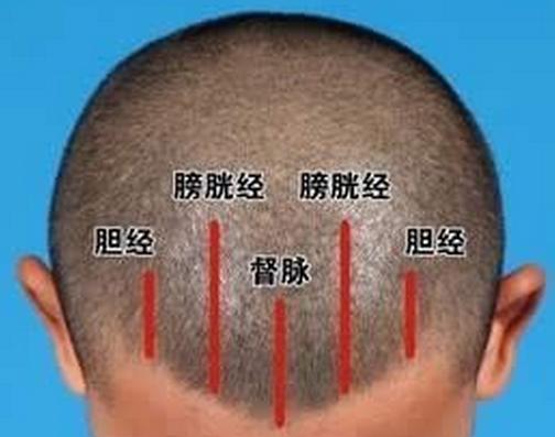 4,梳"五经"预防中风