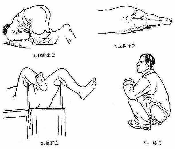 膝胸位 病人雙膝跪於檢查床上,頭胸部貼在床面,臀部抬高,兩膝略分開