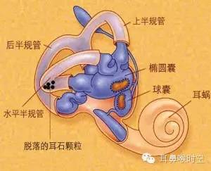 的文章库本文来源:医学百科良性阵发性位置性眩晕,又叫壶腹嵴顶耳石症