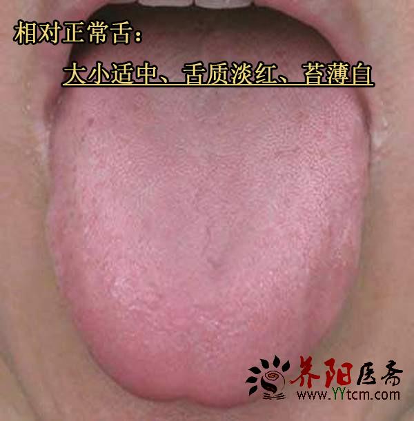 健康正常舌头的图片图片