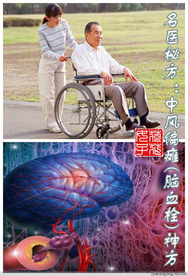 名医秘方中风偏瘫脑血栓神方半夏厚朴汤组新方治中风中风了为什么不要