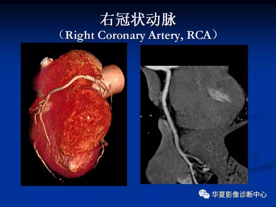详细解读冠状动脉及冠心病ct - 好网角收藏夹