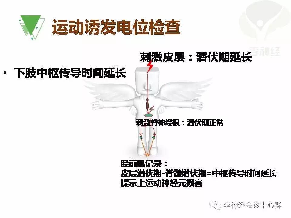 ppt漸凍人運動神經元病als肌電圖與臨床馮淑豔