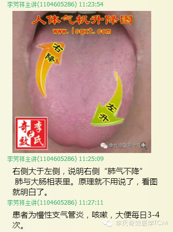 李氏全息舌诊与用药四
