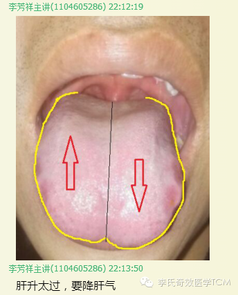 肺区凹凸的病理意义和诊断价值:验证结果:对话 2:上肢部的舌中反射区