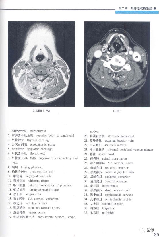 颈部连续横断层图谱收藏人体解剖断层解剖学图谱系列