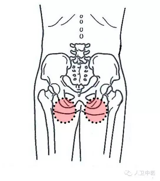 盆腔炎压痛点图片图片
