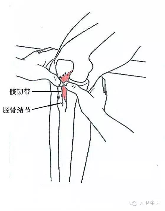 三十七,髌上滑囊尖压痛点