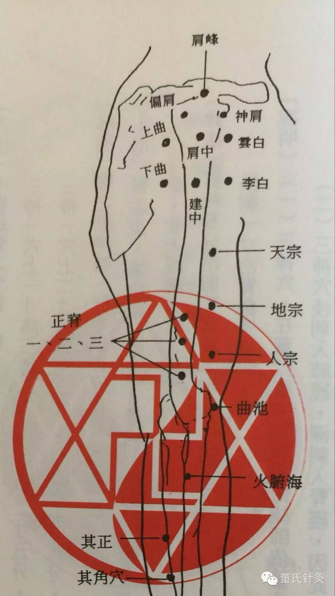 董氏針灸培訓班網絡課程之手六及肩六穴