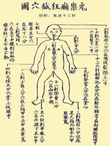 无神无鬼的鬼门十三针