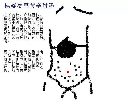 来看看中医的腹诊