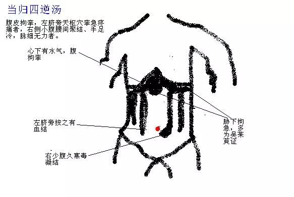 来看看中医的腹诊