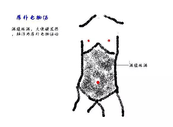 《伤寒论·辨少阳病脉证并治》云"伤寒五六日,中风,往来寒热,胸胁苦