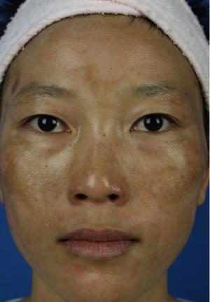 神农本草经一个方子改善气血双亏面色黄瘦睡眠不好