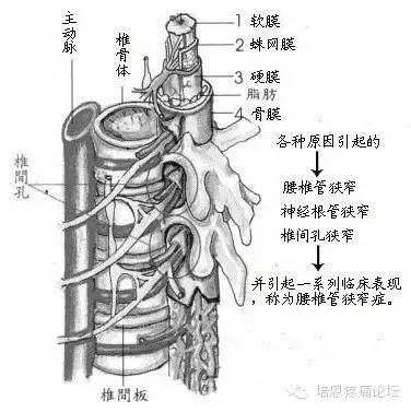 侧隐窝阻滞综述
