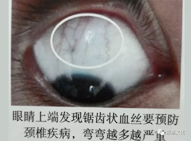 眼诊彩◇◇谱大全(珍藏版)