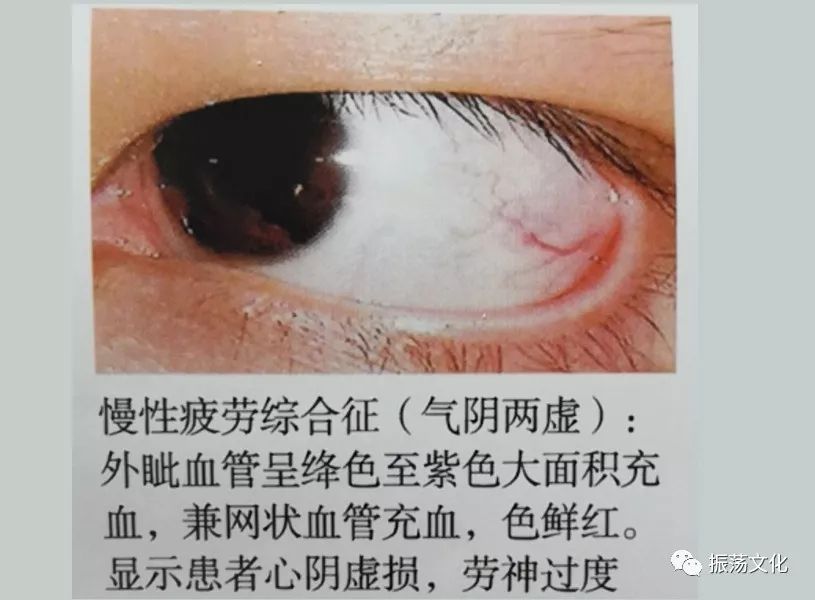 眼诊彩◇◇谱大全(珍藏版)