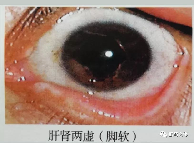 眼诊彩◇◇谱大全(珍藏版)