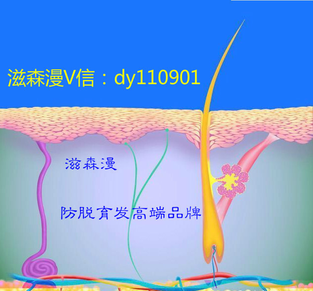 脱发人拯救者—滋森漫隆重招商